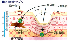 お肌のトラブルの図